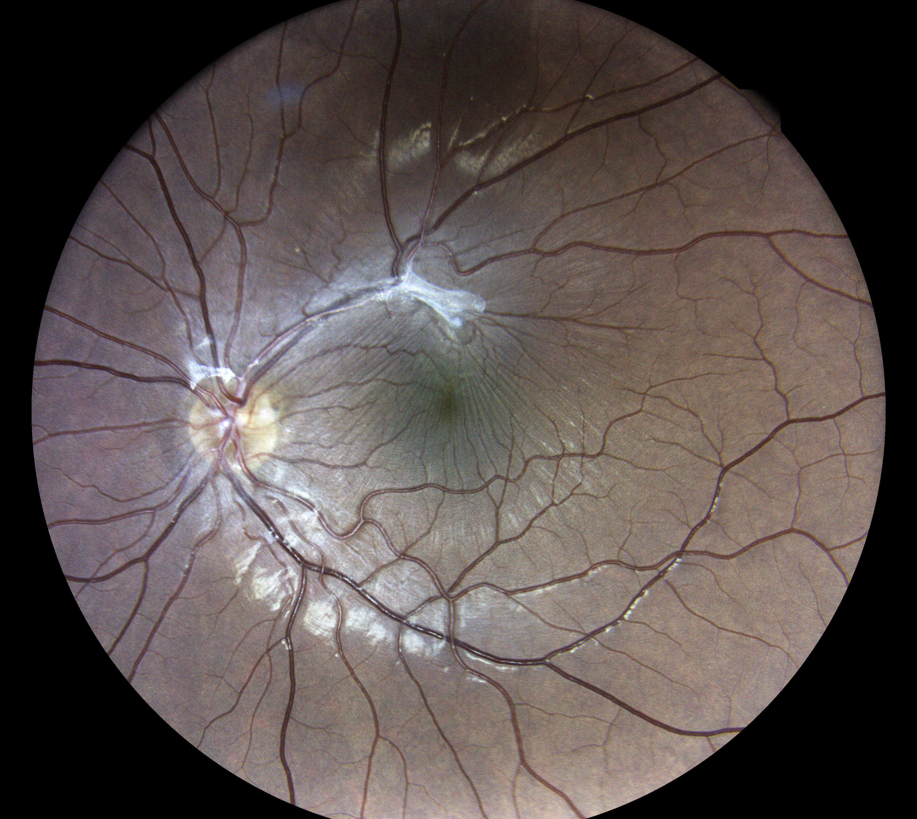  Courtesy of Dr Vincent Gualino, Montauban, France 