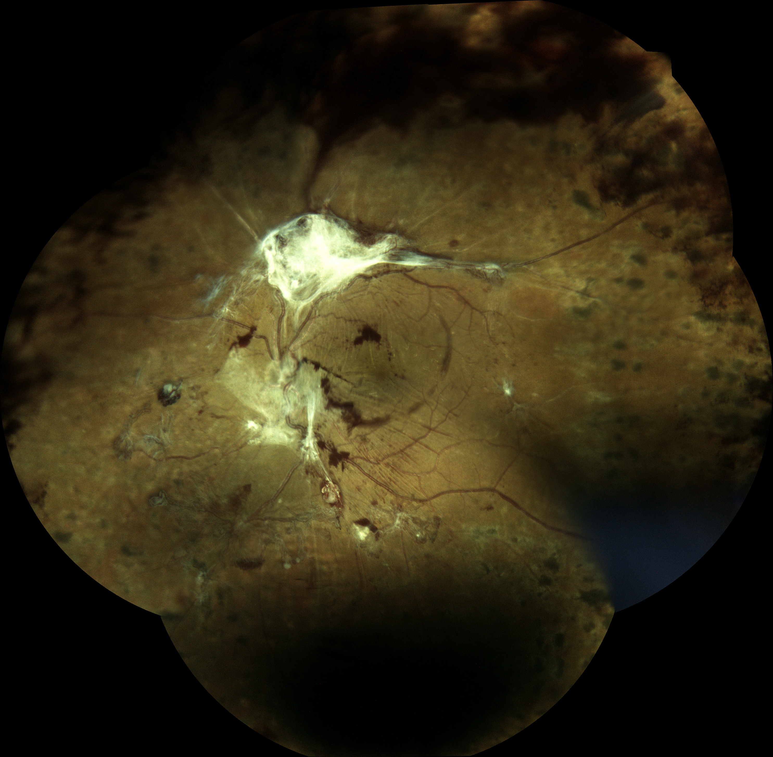  Courtesy of Dr Vincent Gualino, Montauban, France 