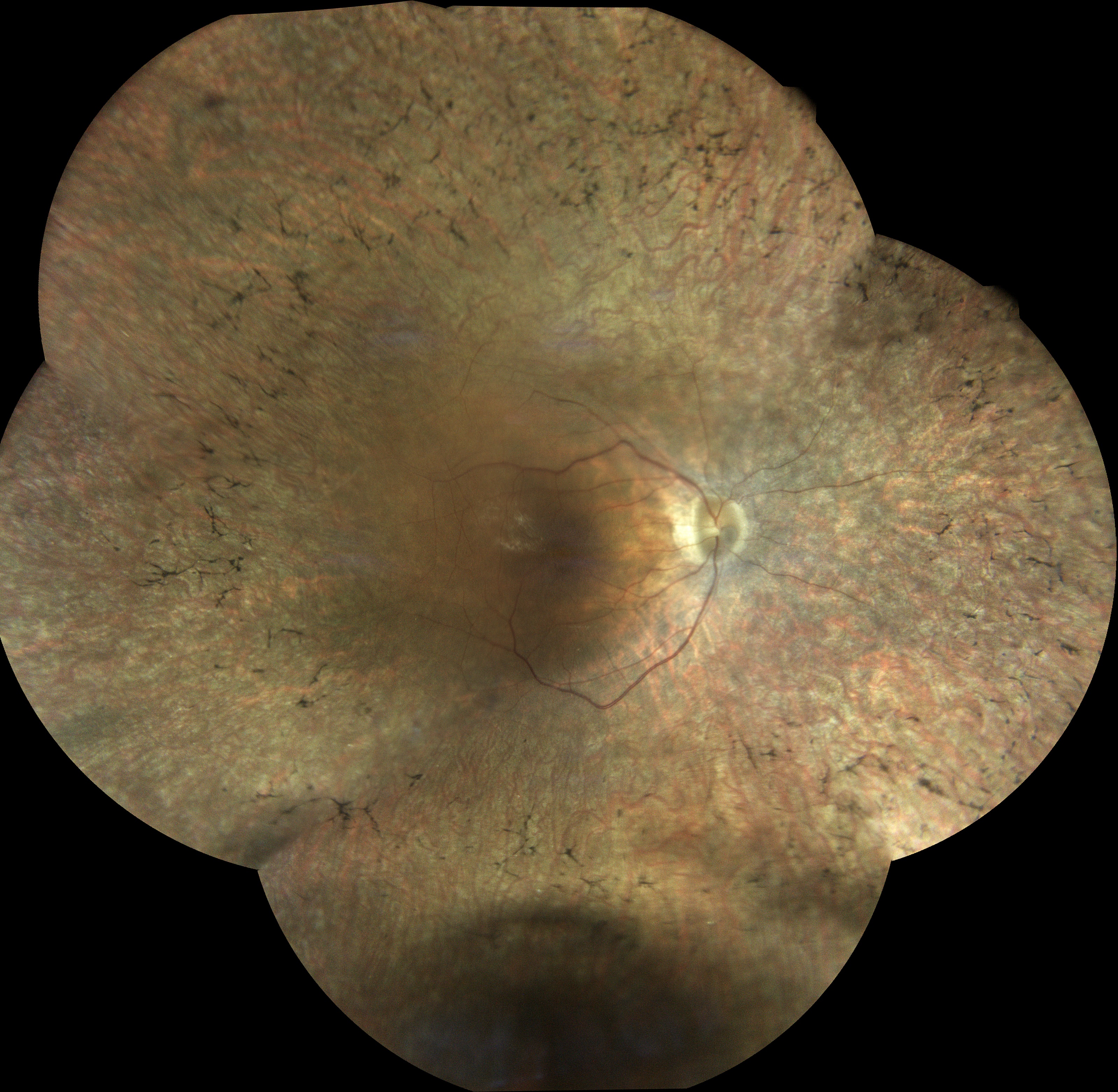  Courtesy of Dr Vincent Gualino, Montauban, France 