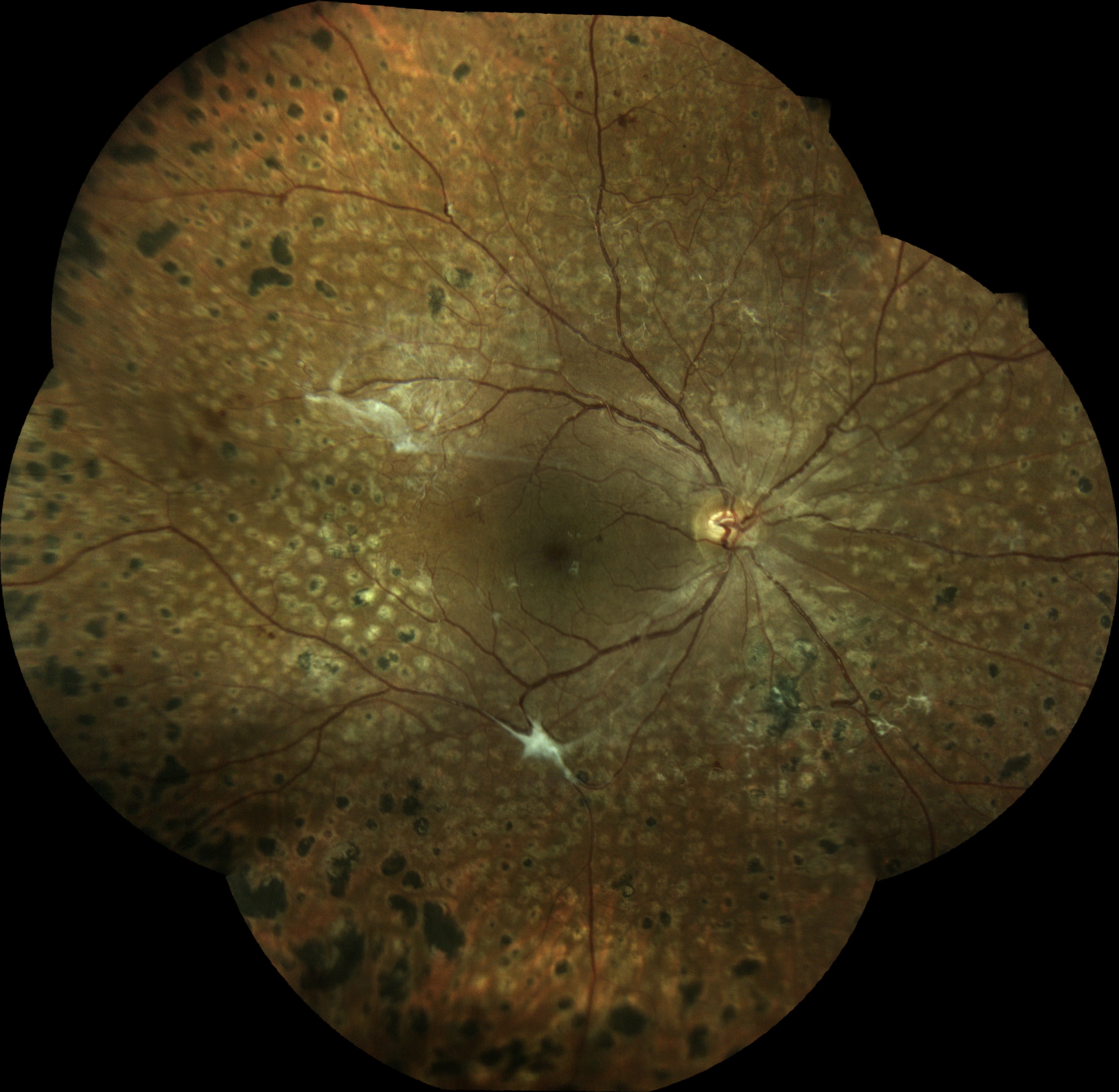  Courtesy of Pr Pierre Labalette, Lille, France 