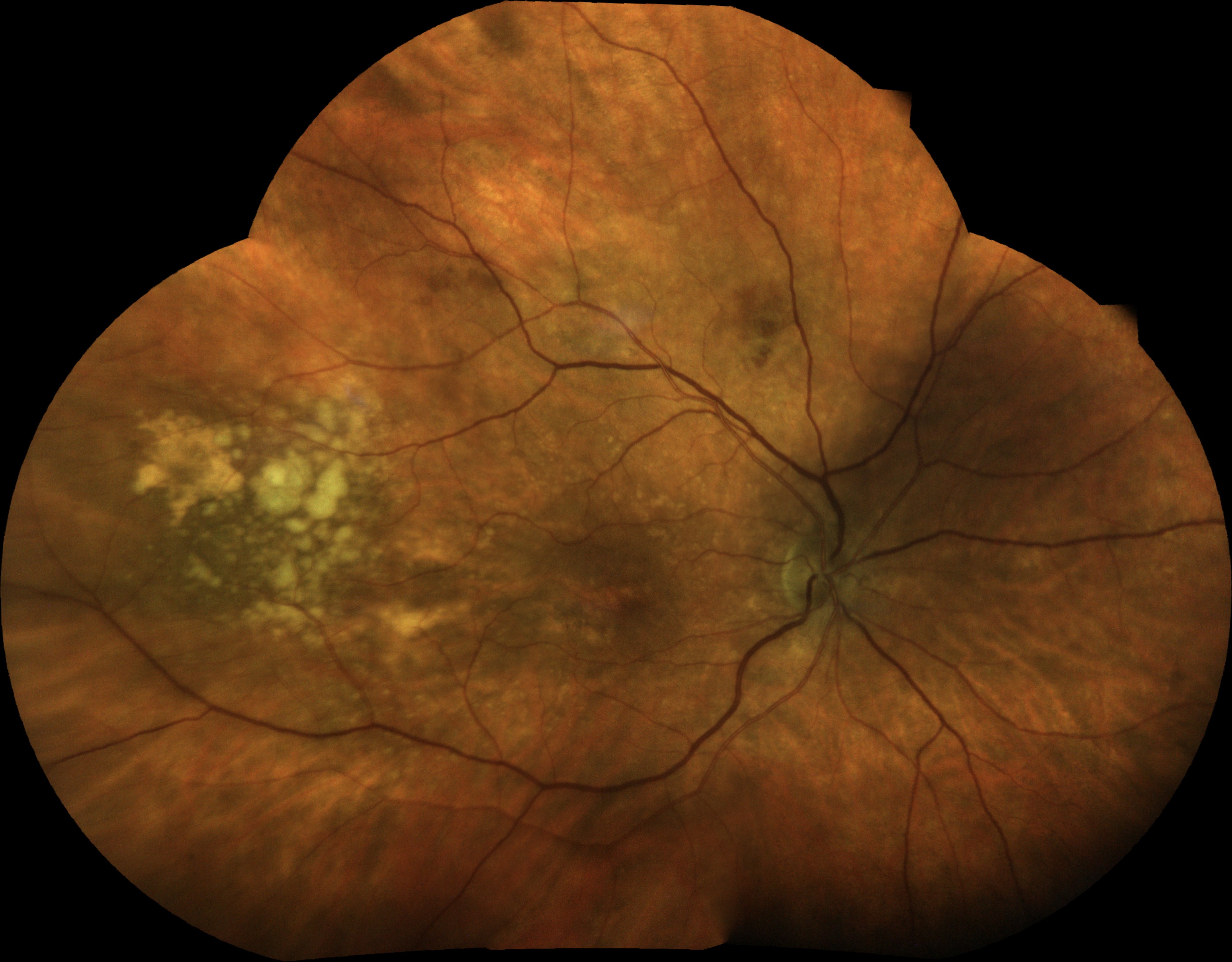  Courtesy of Pr Pierre Labalette, Lille, France 