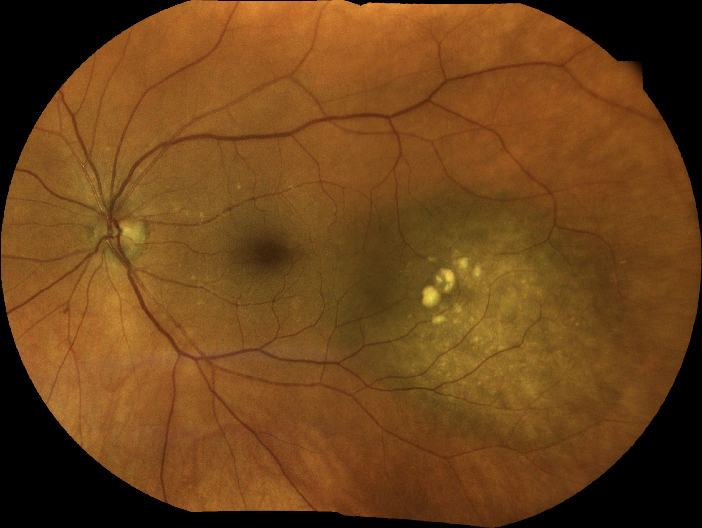  Courtesy of Pr Pierre Labalette, Lille, France 