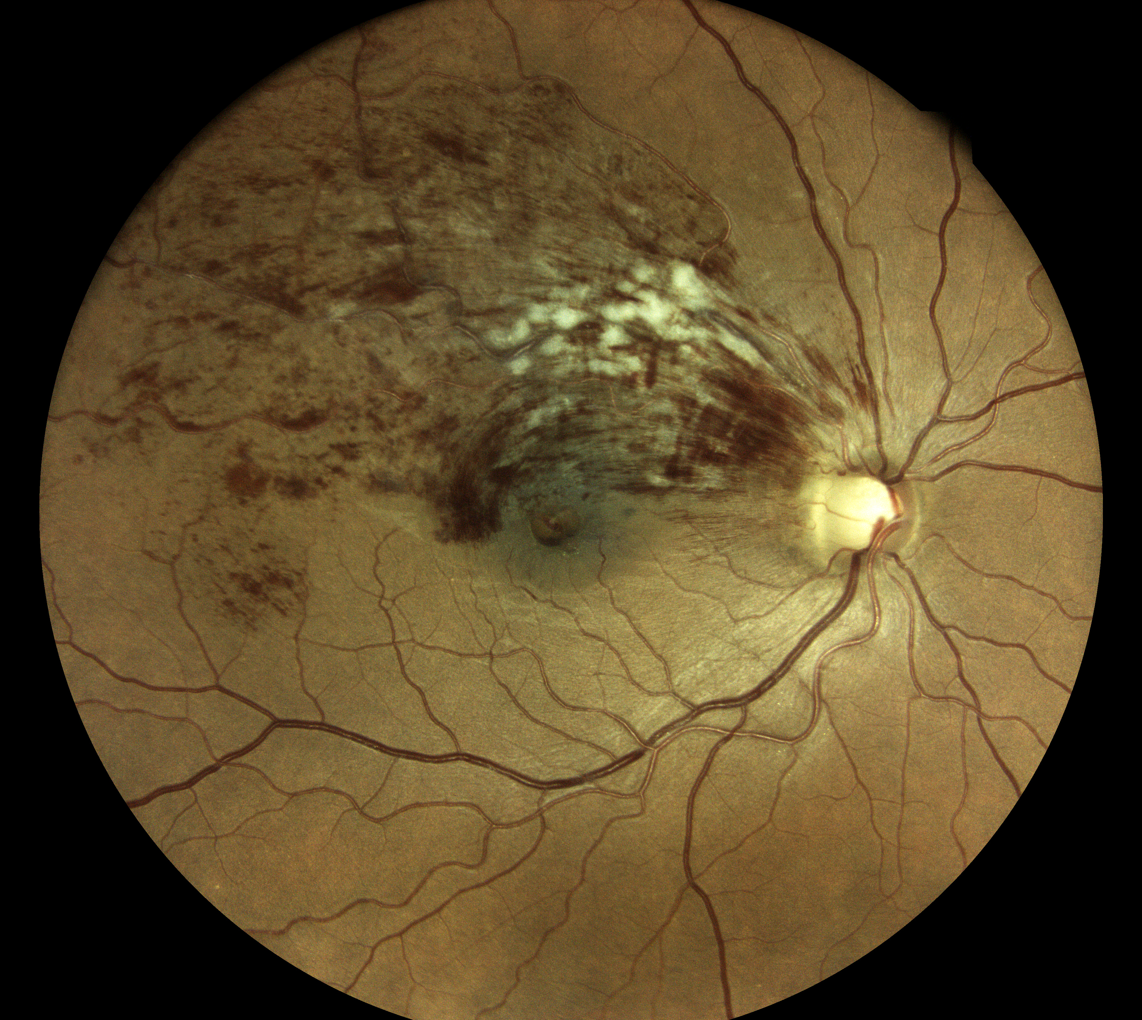  Courtesy of Dr Vincent Gualino, Montauban, France 