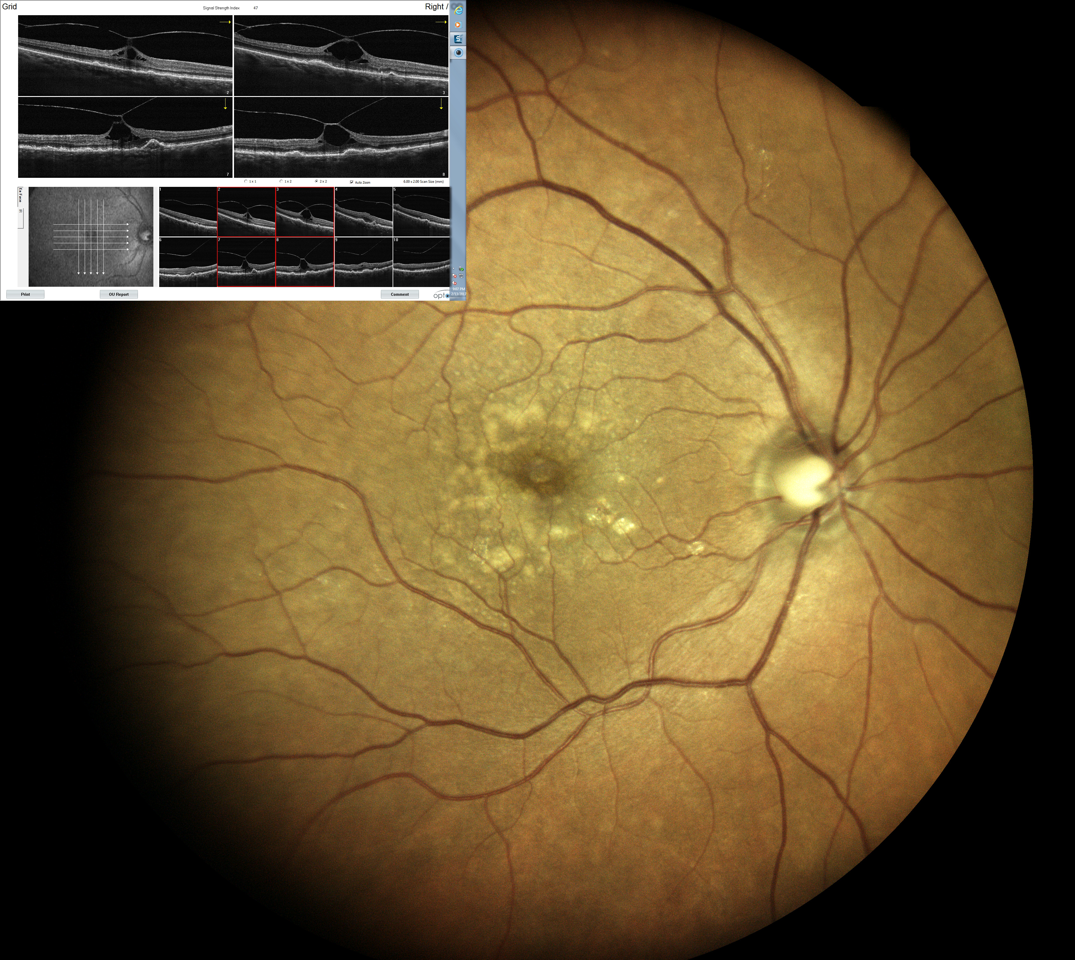  Courtesy of Dr Jean-Michel Muratet, Pamiers, France 