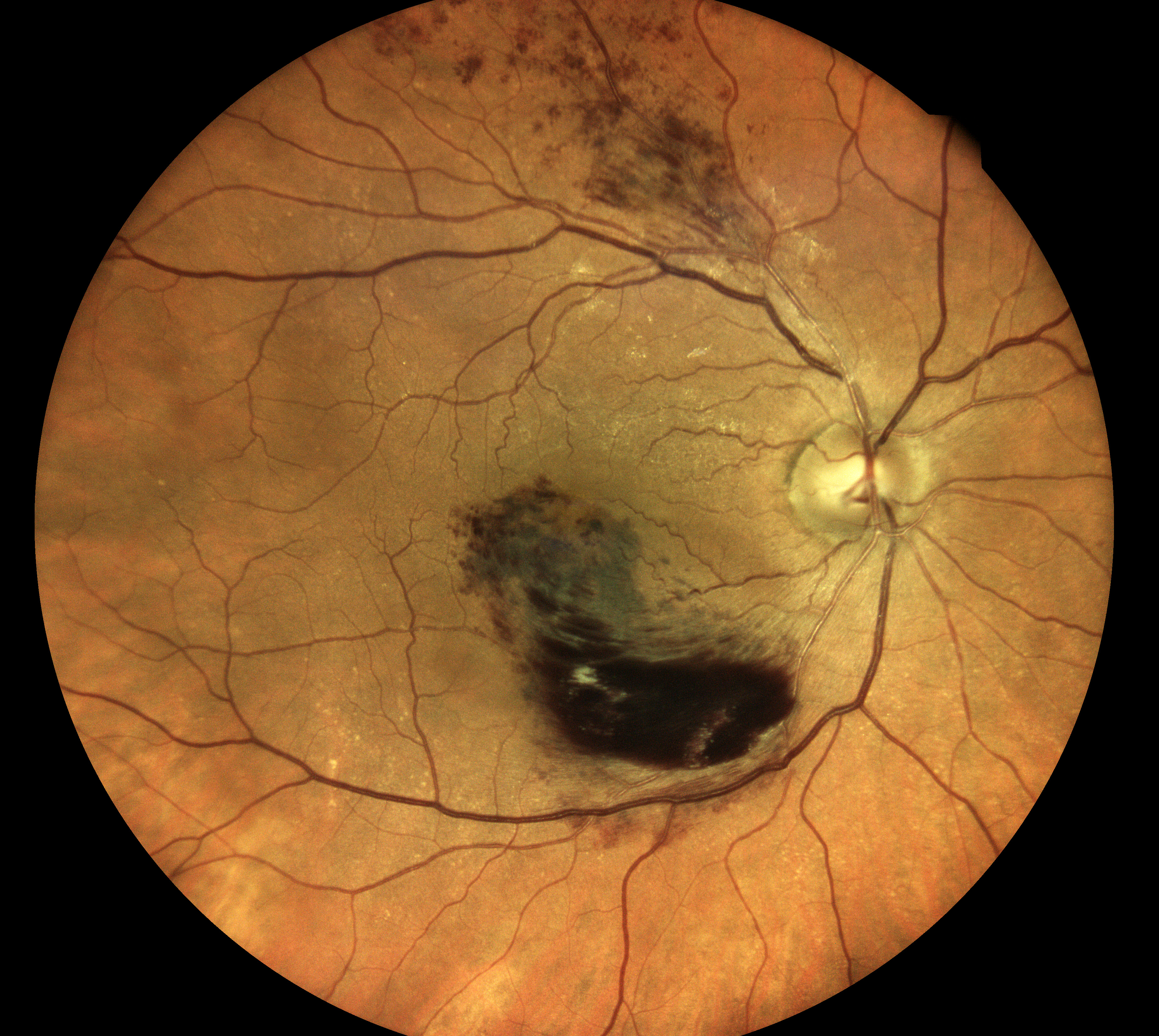  Courtesy of Dr Jean-Michel Muratet, Pamiers, France 