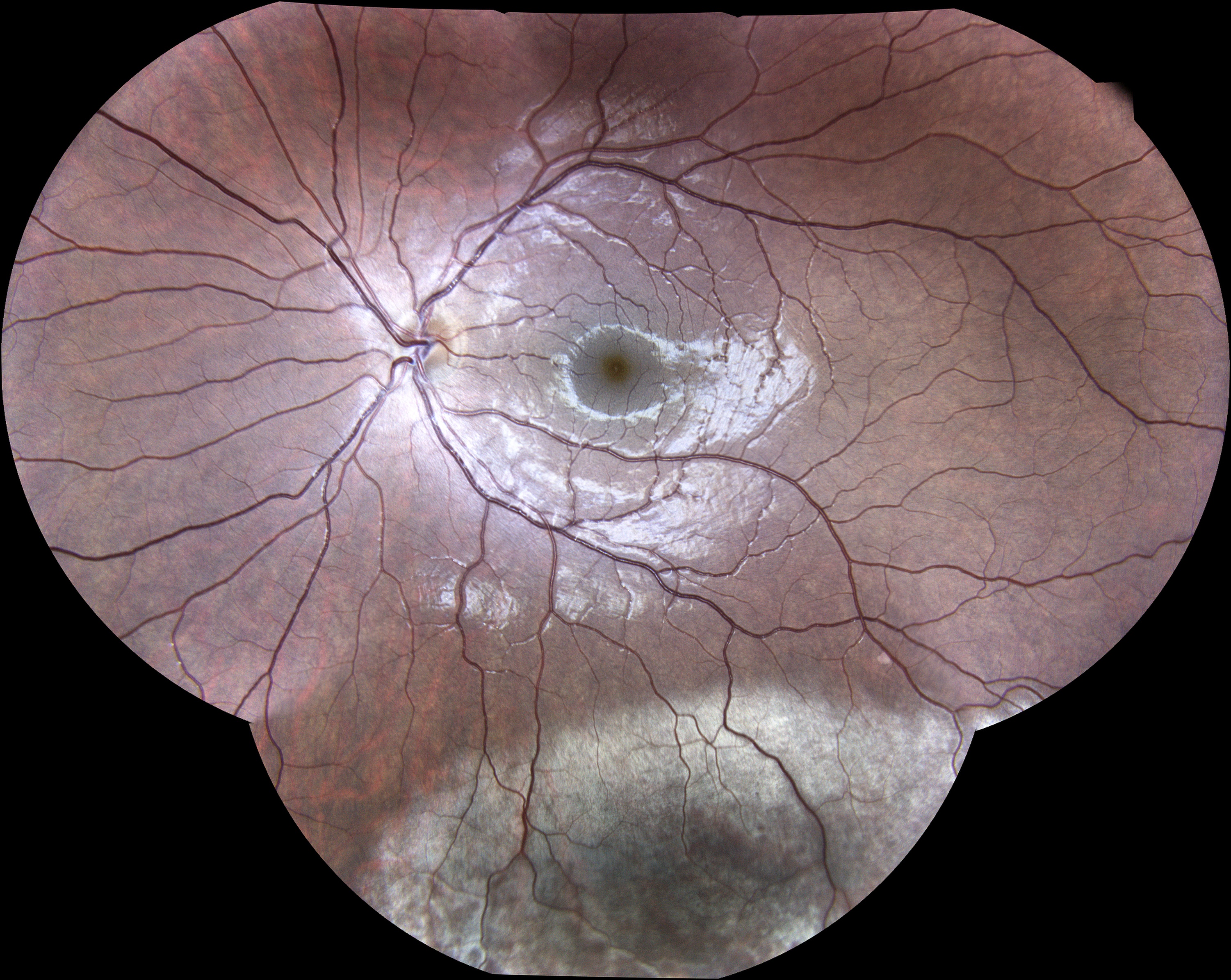  Boxing / Courtesy of Dr Jean-Michel Muratet, Pamiers, France 