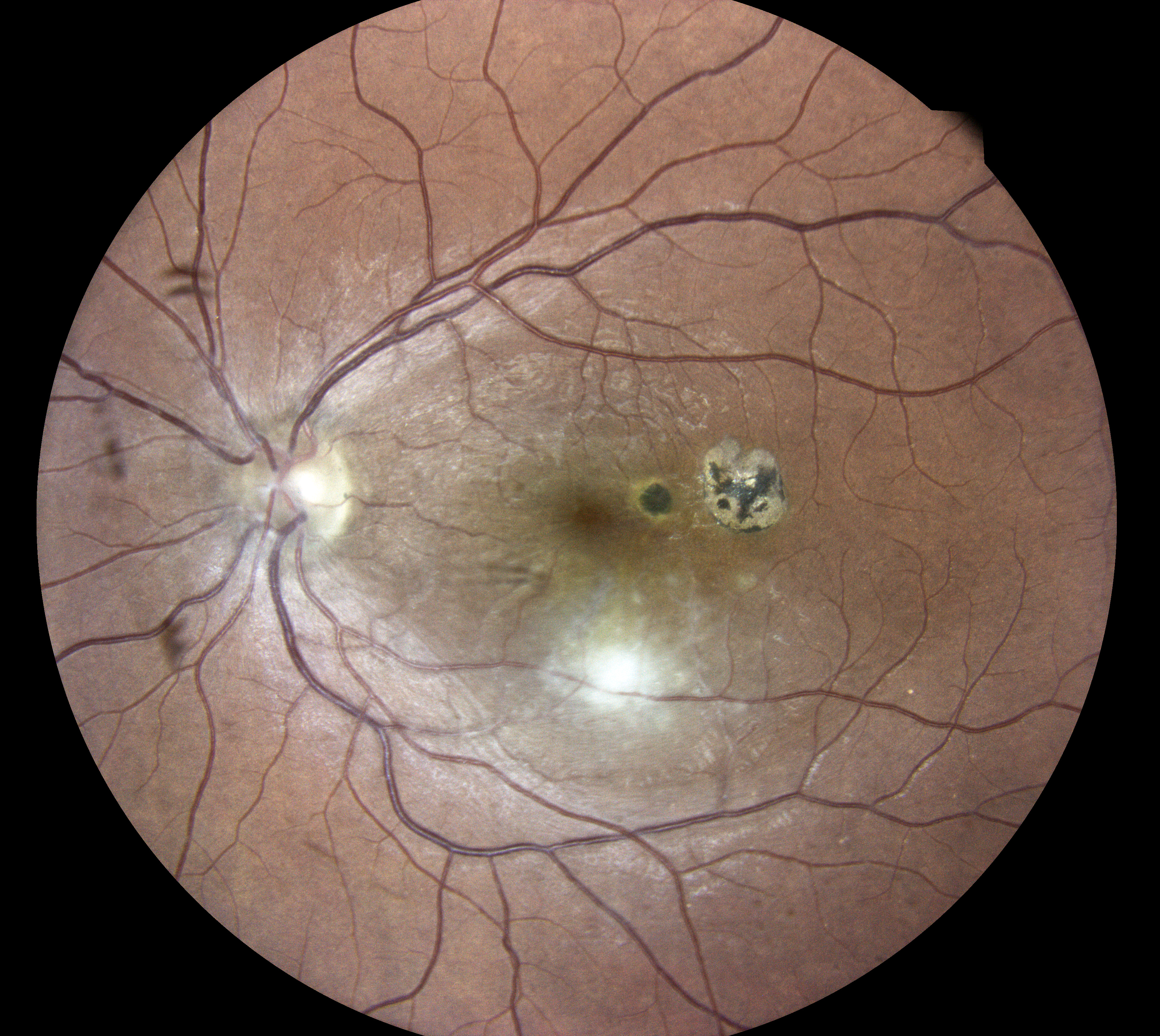  Courtesy of Dr Jean-Michel Muratet, Pamiers, France 