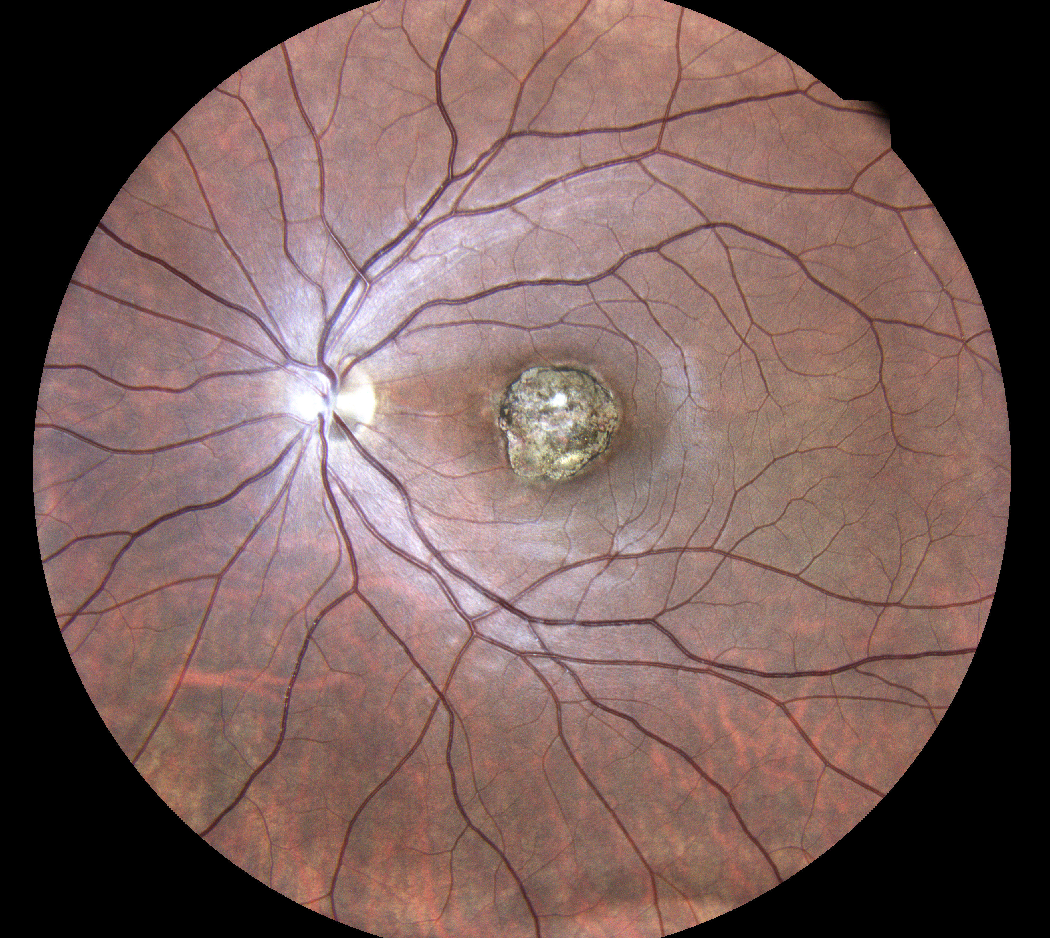  Courtesy of Dr Jean-Michel Muratet, Pamiers, France 